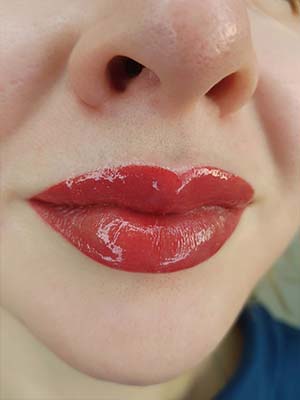 Фото после 1