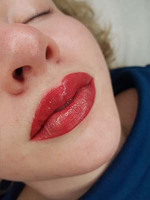 Фото после 3